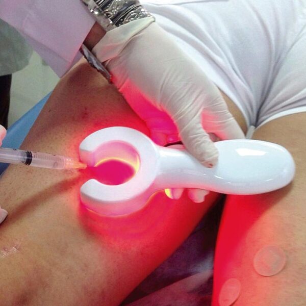 VF 1000 - VEIN LOCATOR - Image 3